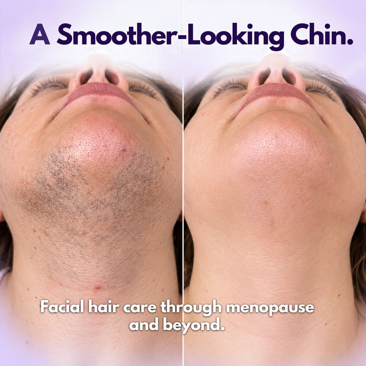 UNRAZOR Facial hair removal cream