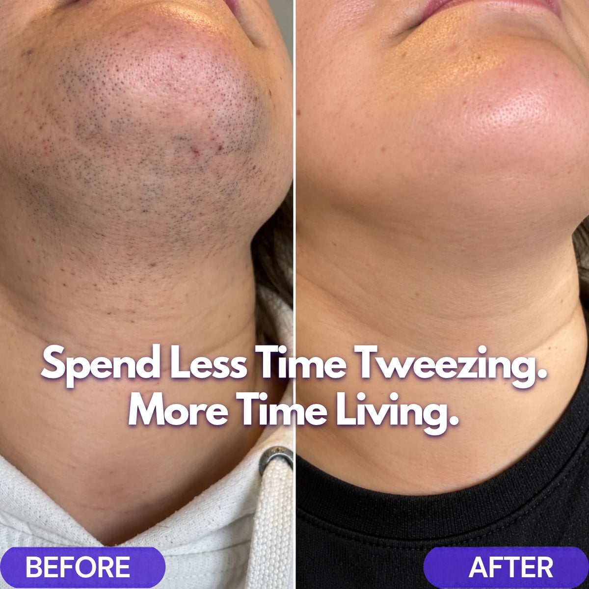 UNRAZOR Facial hair removal cream