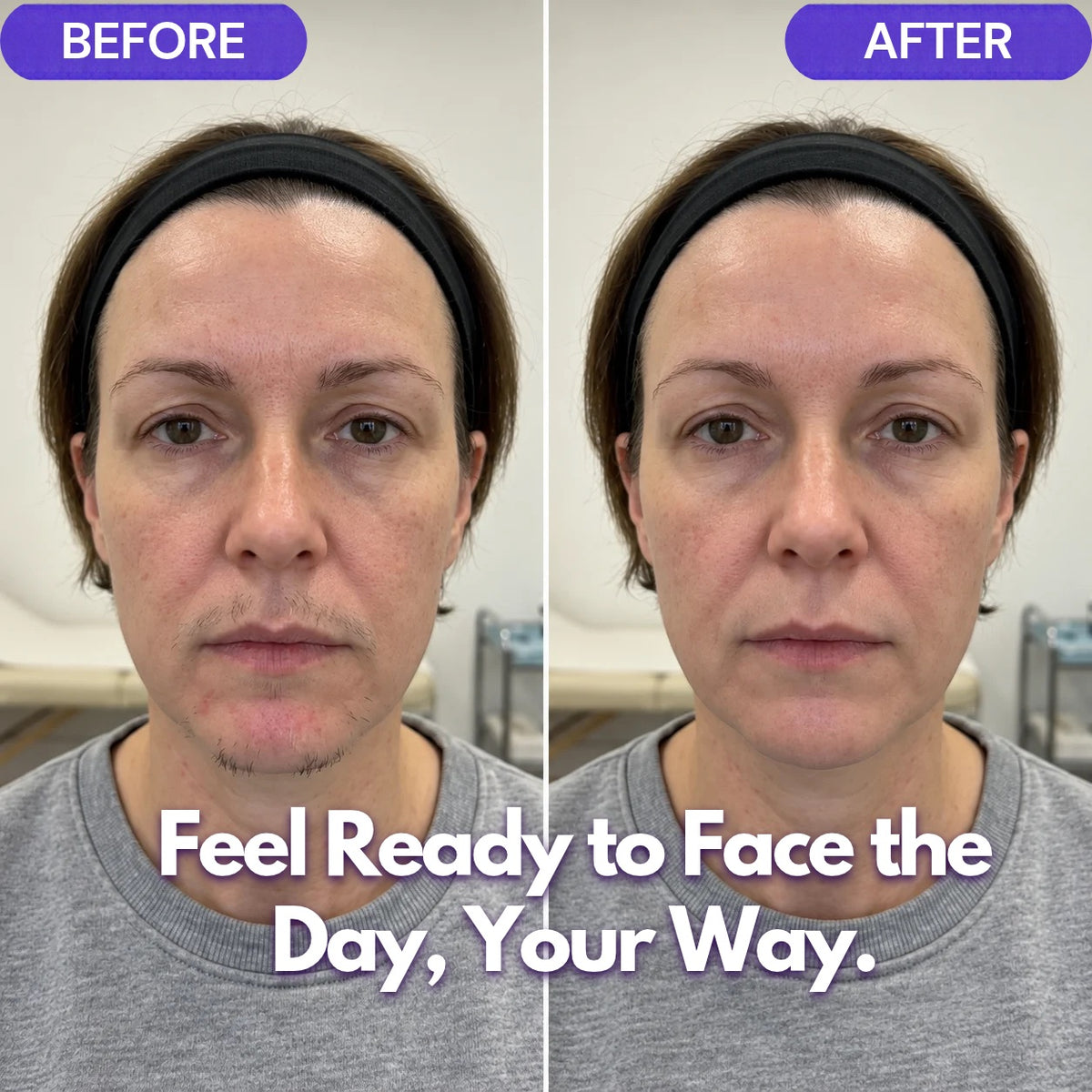 UNRAZOR Facial hair removal cream