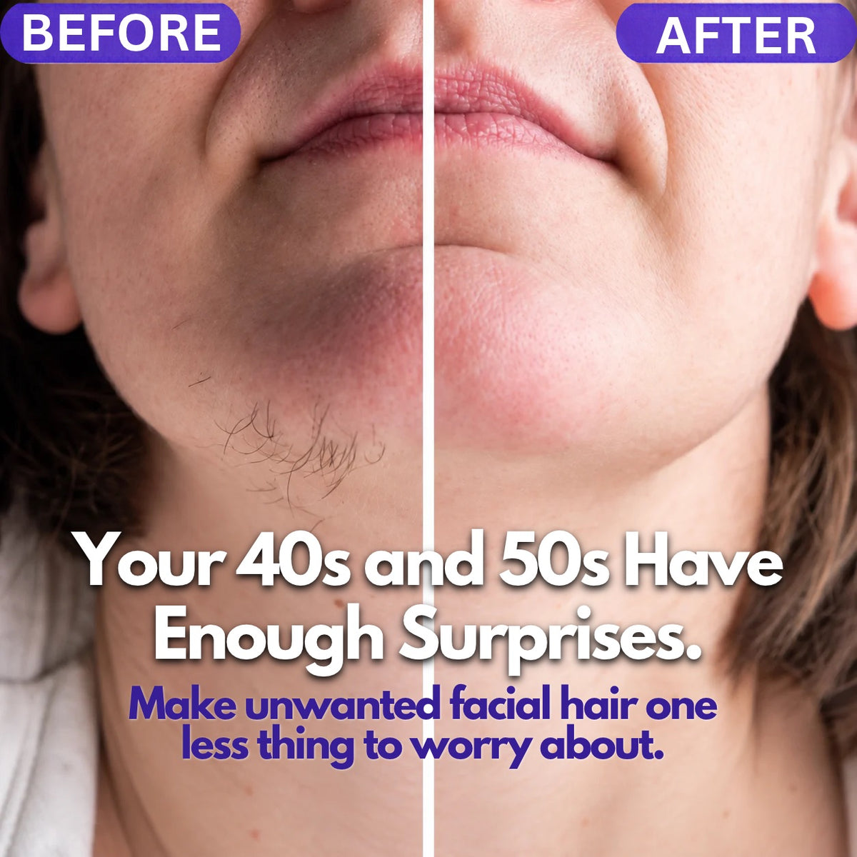 UNRAZOR Facial hair removal cream