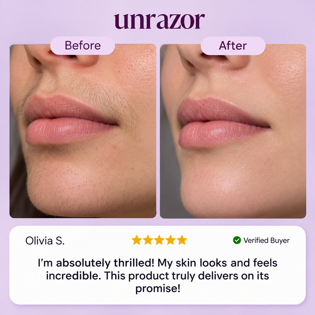 UNRAZOR Facial hair removal cream
