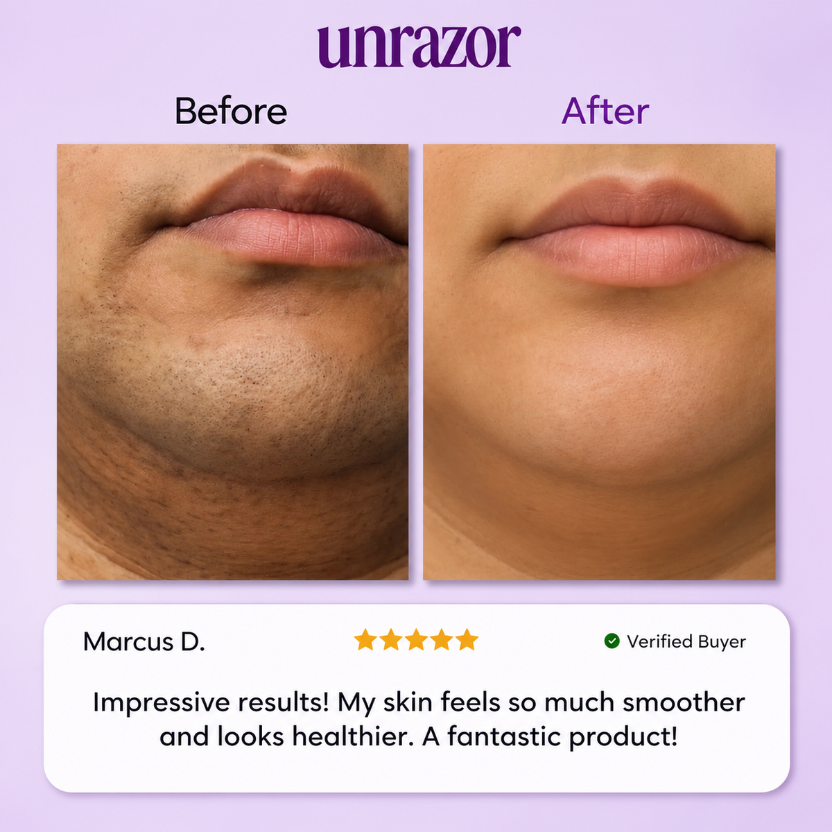 UNRAZOR Facial hair removal cream
